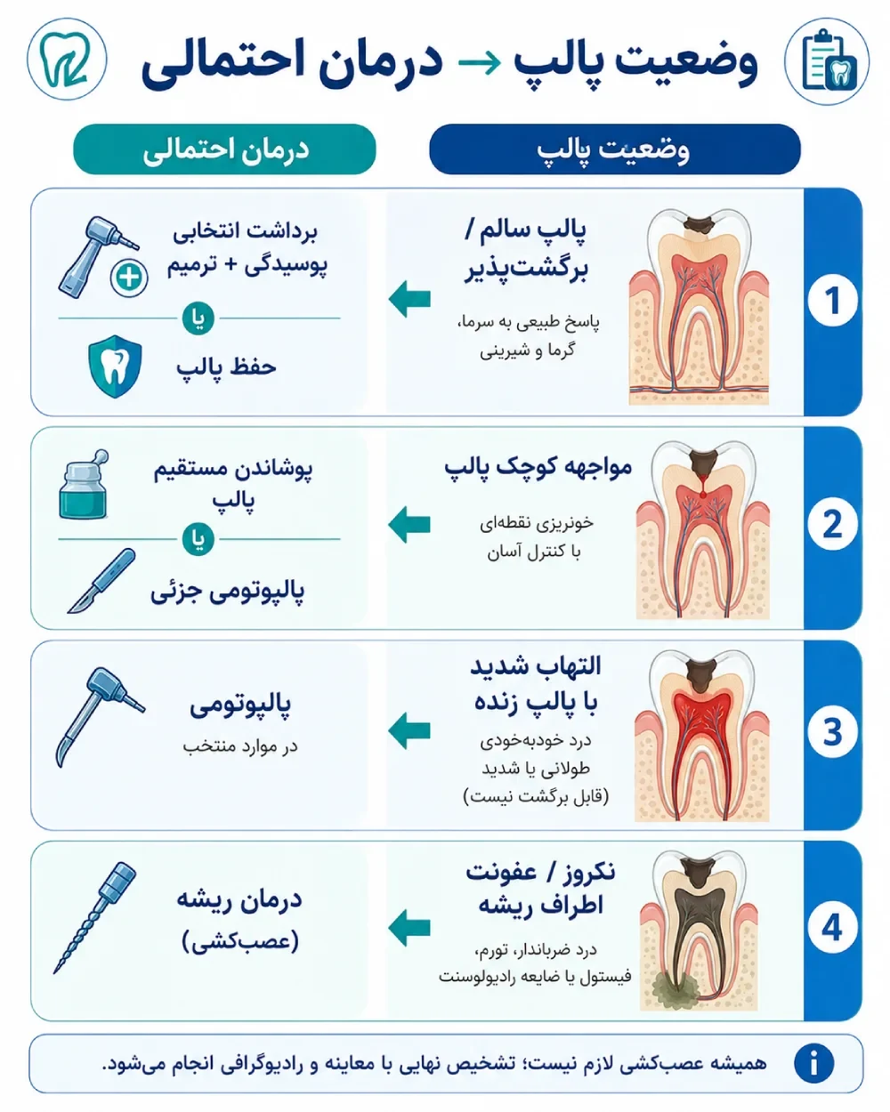 اینفوگراف مسیر تصمیمگیری درمان پوسیدگی عمیق از حفظ پالپ تا عصبکشی
