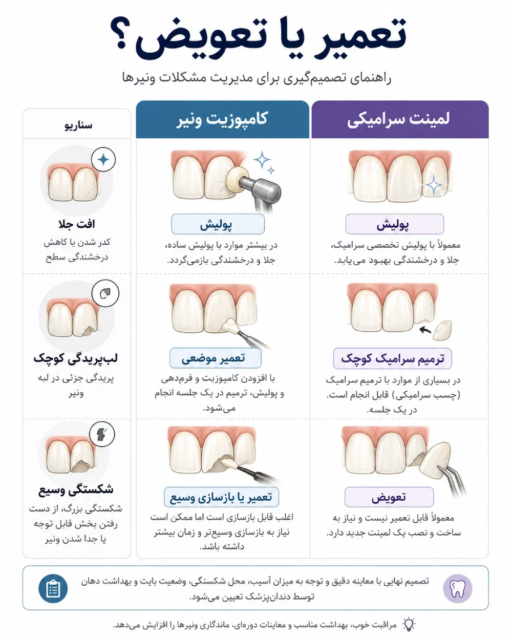 مقایسه تعمیر و نگهداری کامپوزیت ونیر و لمینت سرامیکی
