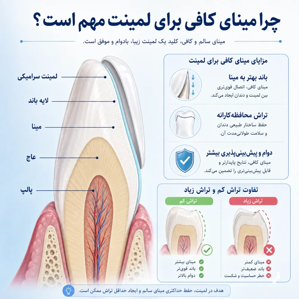مقایسه باندینگ لمینت به مینا و عاج دندان
