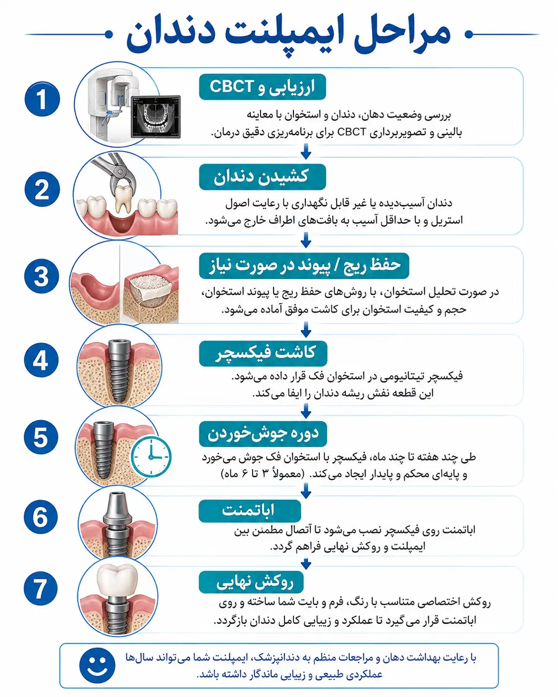 اینفوگراف مراحل ایمپلنت از ارزیابی و کشیدن دندان تا فیکسچر، اباتمنت و روکش نهایی