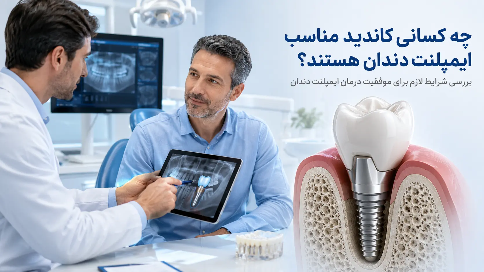 چه کسانی کاندید مناسب ایمپلنت دندان هستند؟