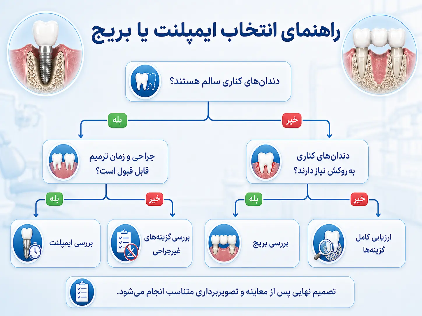 نمودار تصمیم‌گیری برای انتخاب ایمپلنت یا بریج براساس دندان‌های مجاور و وضعیت استخوان