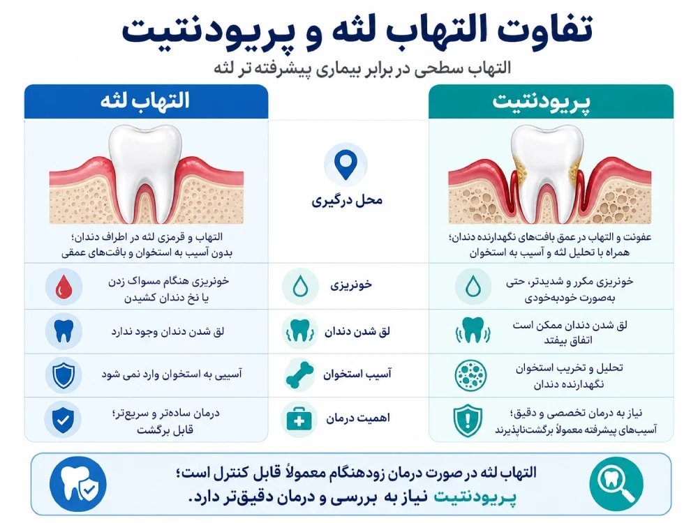 تفاوت التهاب لثه و پریودنتیت
