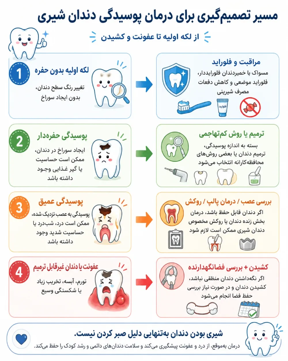 مسیر انتخاب درمان پوسیدگی دندان شیری از لکه اولیه تا عفونت و کشیدن