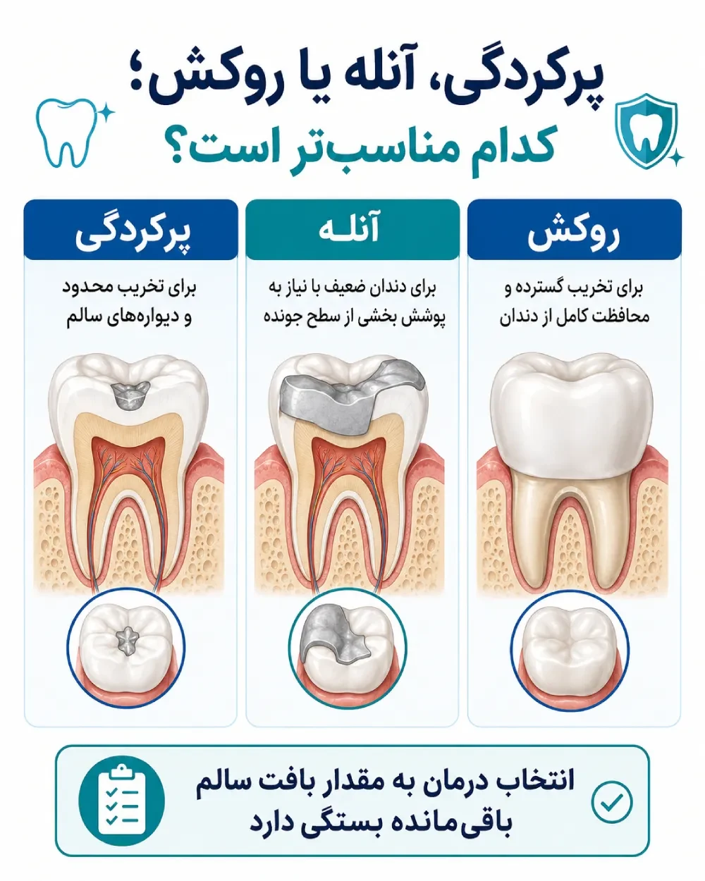 مقایسه پرکردگی، آنله و روکش بر اساس مقدار بافت سالم باقیمانده دندان